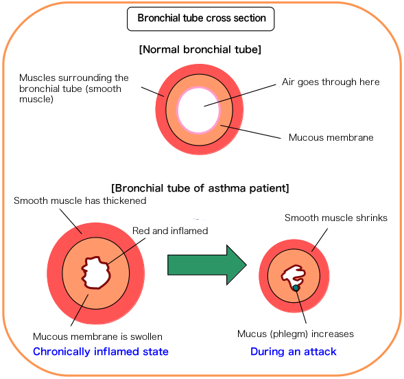 Bronchial tube cross section