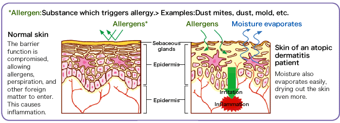 Illustration of substances which trigger allergies