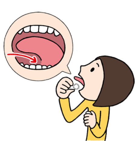 舌下免疫療法のイラスト