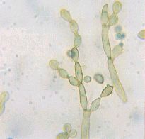 Cladosporium cladosporioides2